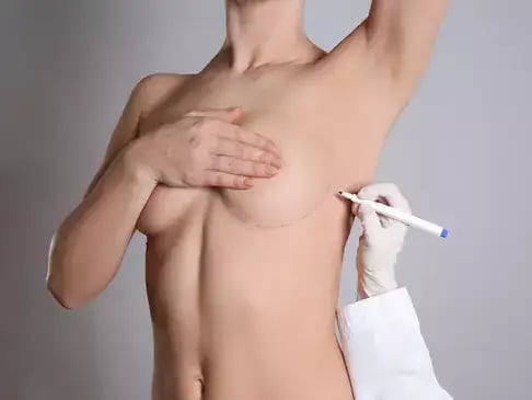 breast augmentation patient 