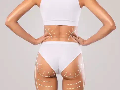 LIV-Plastic-Surgery_Breast-and-Body_Body_Lift