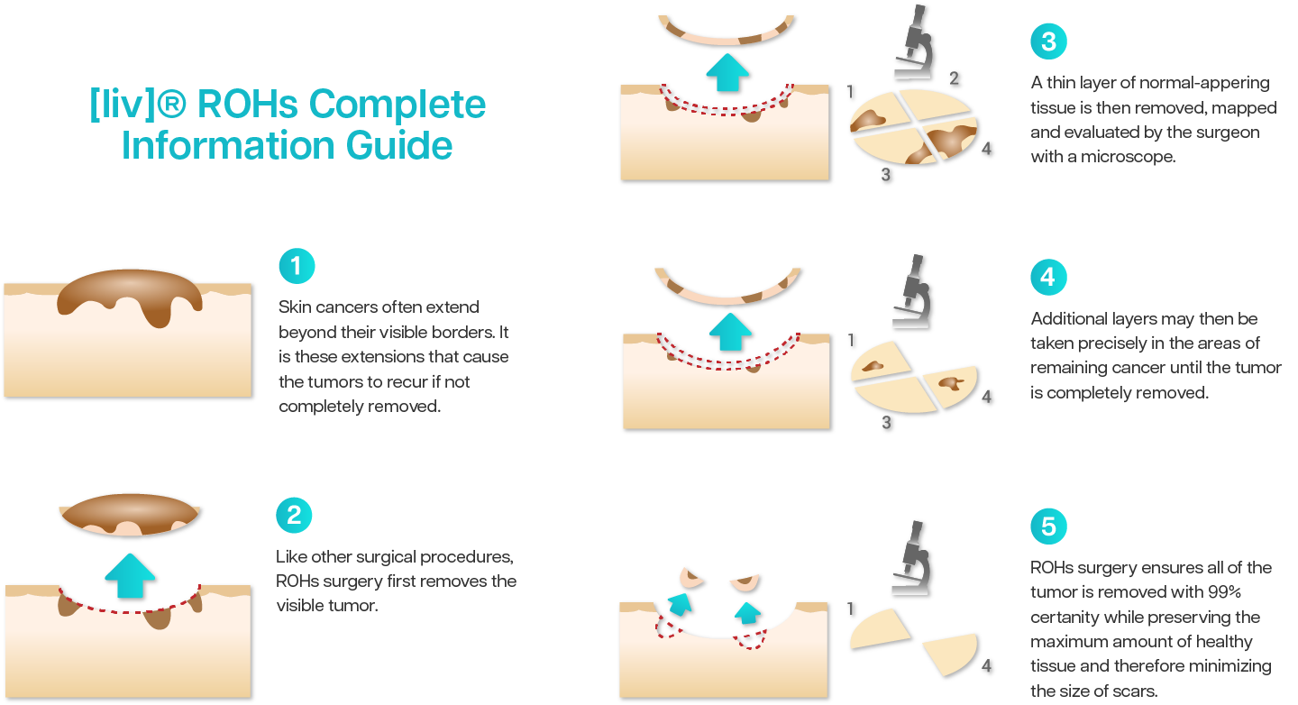 ROHs Infographic ROHs Infographic