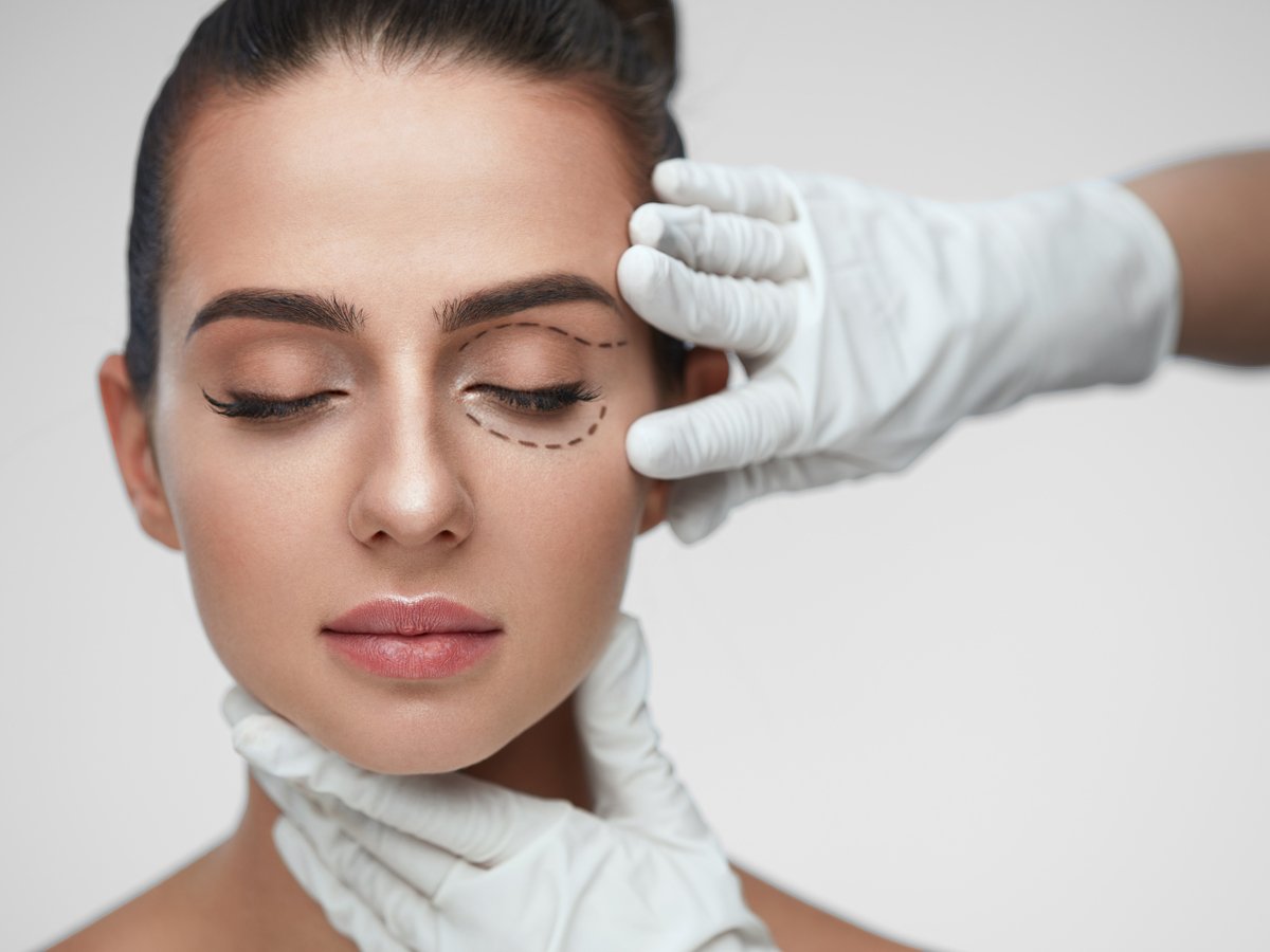 eyelid-surgery eyelid-surgery